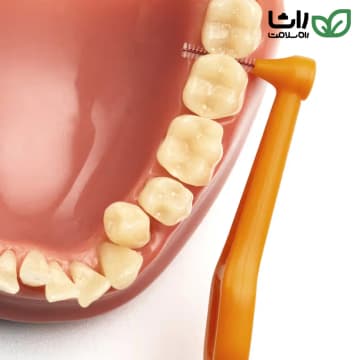 تپه بین دندانی پایه بلند نارنجی- 1 (Angle Orange 01)