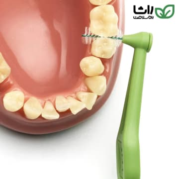 تپه بین دندانی پایه بلند- 5 (Angle Green 05)